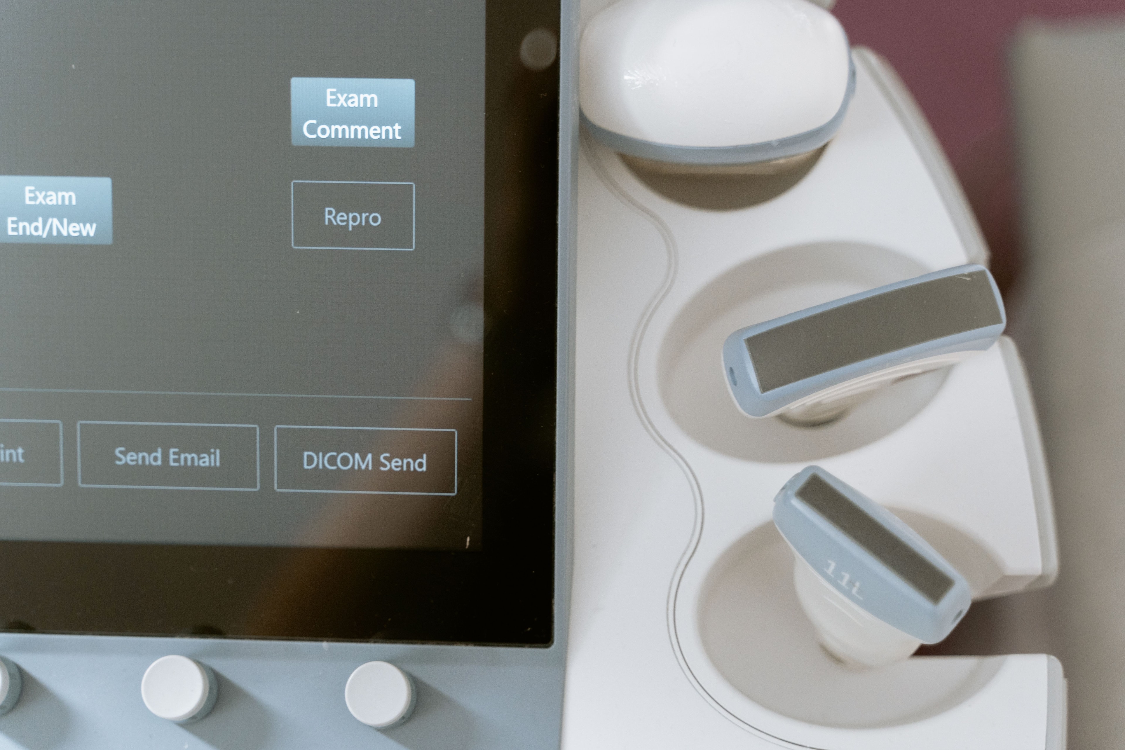 Intravascular ultrasound control panel displaying detailed vessel imaging